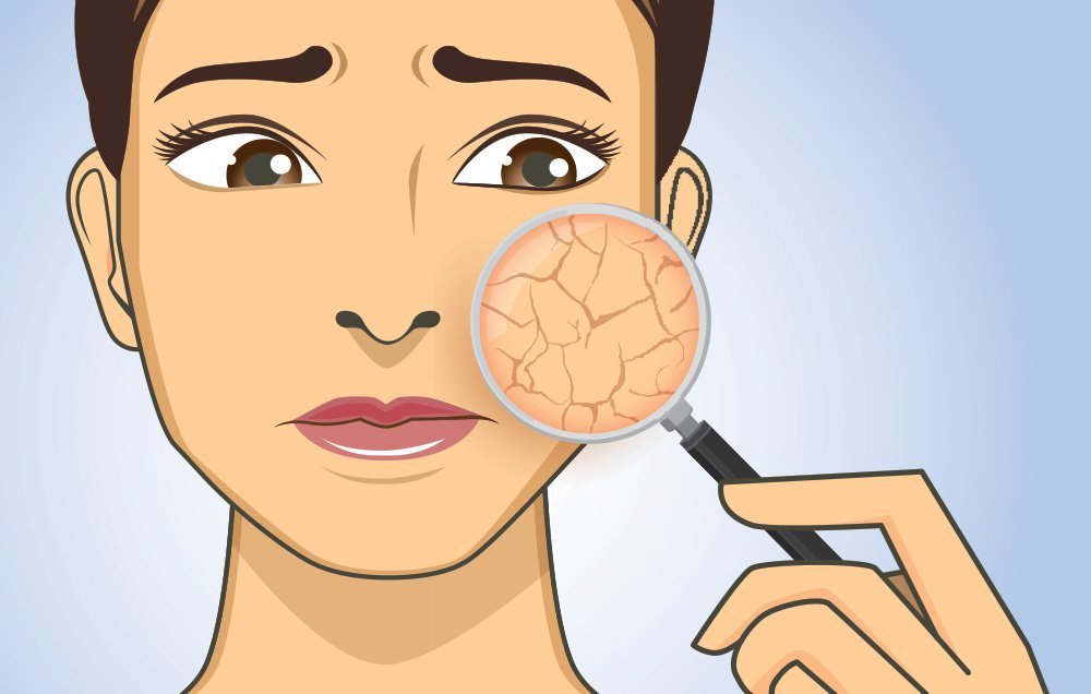 How to avoid dry skin in this cold weather