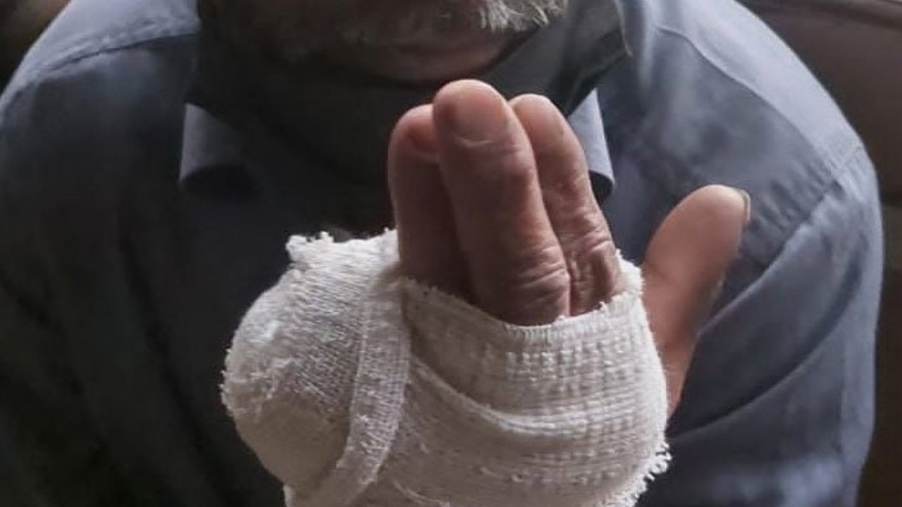 Girl’s father bites off finger of boy’s dad over love marriage clash