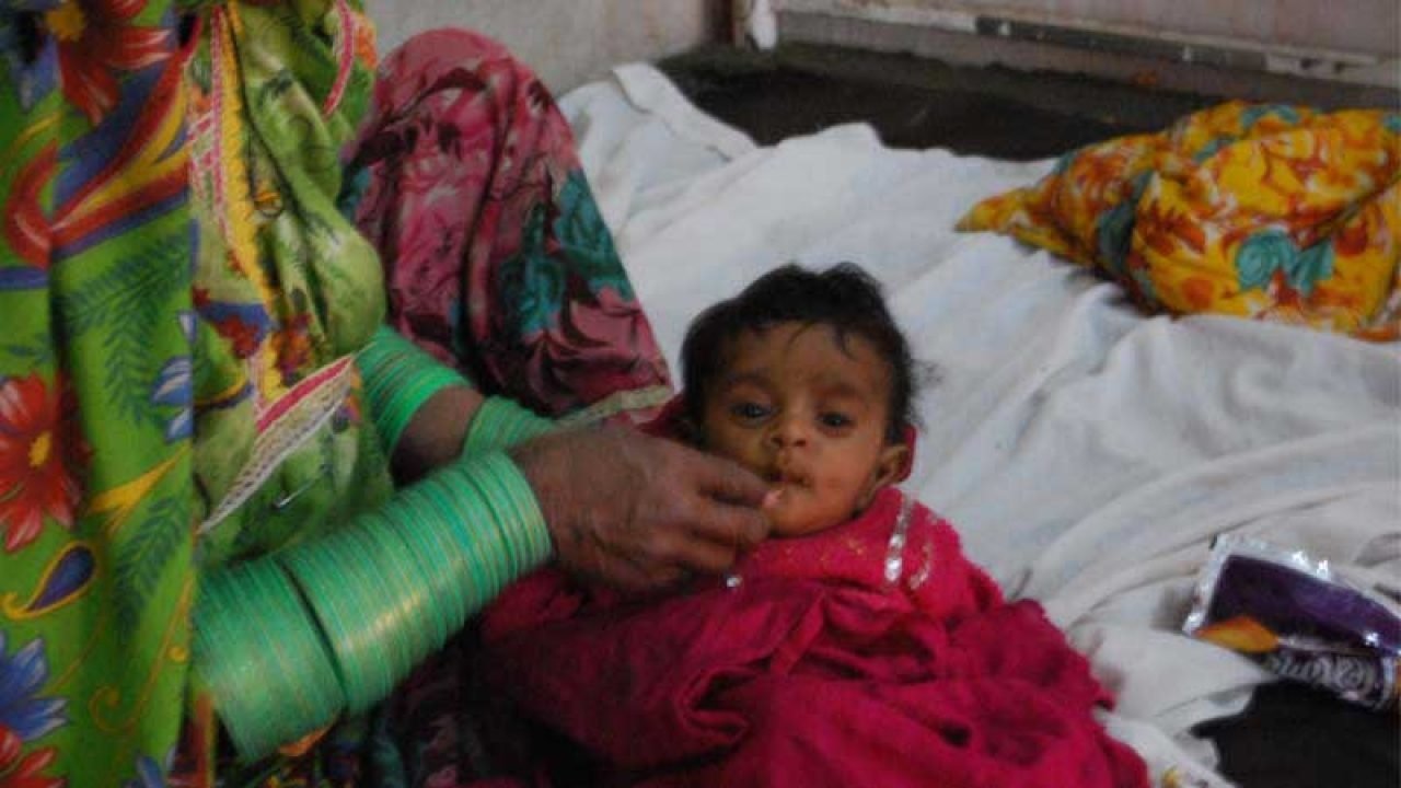 Four more children die of malnutrition in Tharparkar, death toll at 10