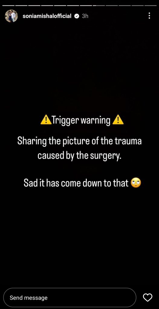 Sonia Mishal Addresses Hearsay About Her Cosmetic Surgery