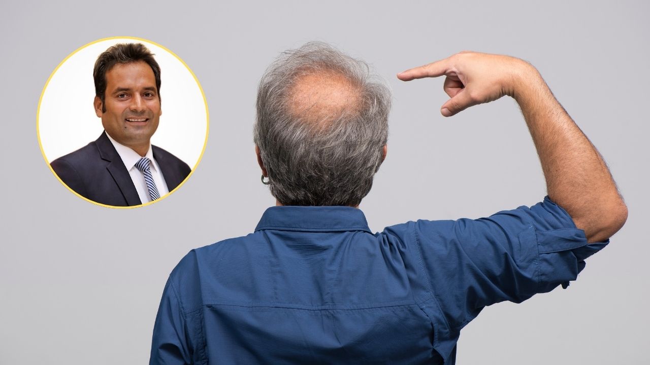 Exclusive: Pakistani scientist on the verge of curing baldness