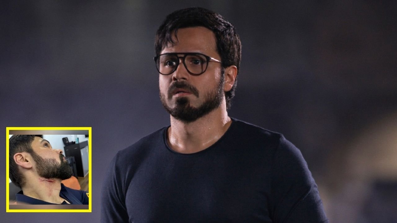 Bollywood actor Emraan Hashmi suffers ‘deep wound’ on set