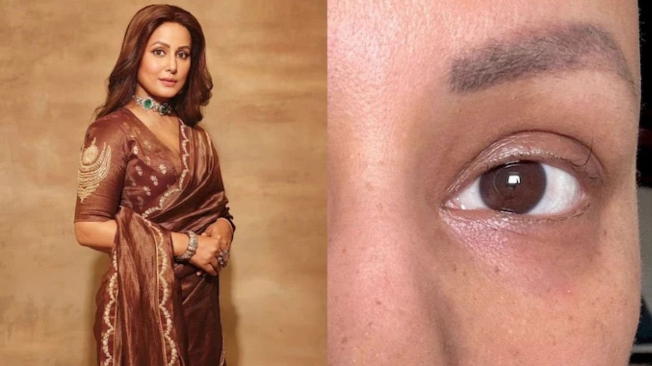 Hina Khan shares moving photo of chemo’s affect on her body